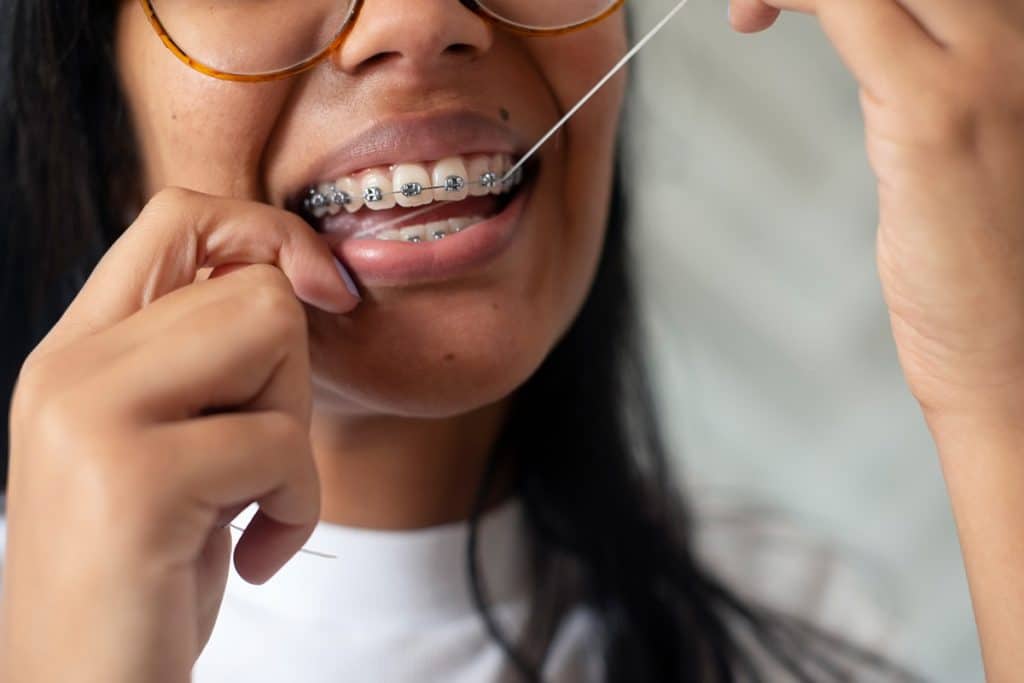 When Should Kids Start Flossing Their Teeth?